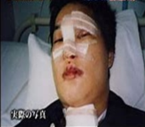千原ジュニアの事故前の顔と事故直後の顔 どっちが好き 事故の詳細が酷い ヒマツブシ