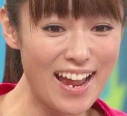 深田恭子の下の歯並びがガタガタ 歯列矯正をしない理由は多忙のため ヒマツブシ